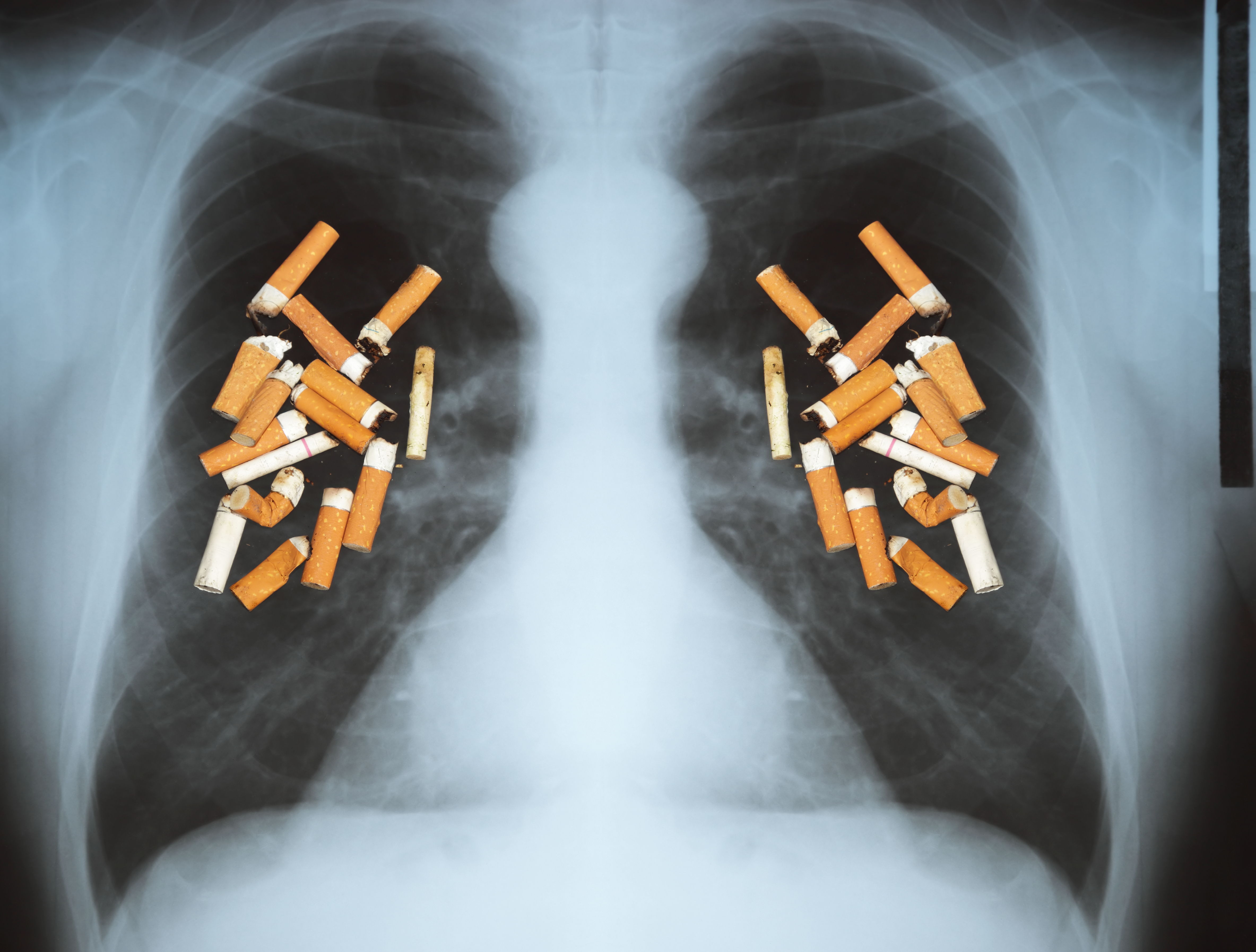 Does Vaping Cause Popcorn Lung Vapor Galleria Allentown PA